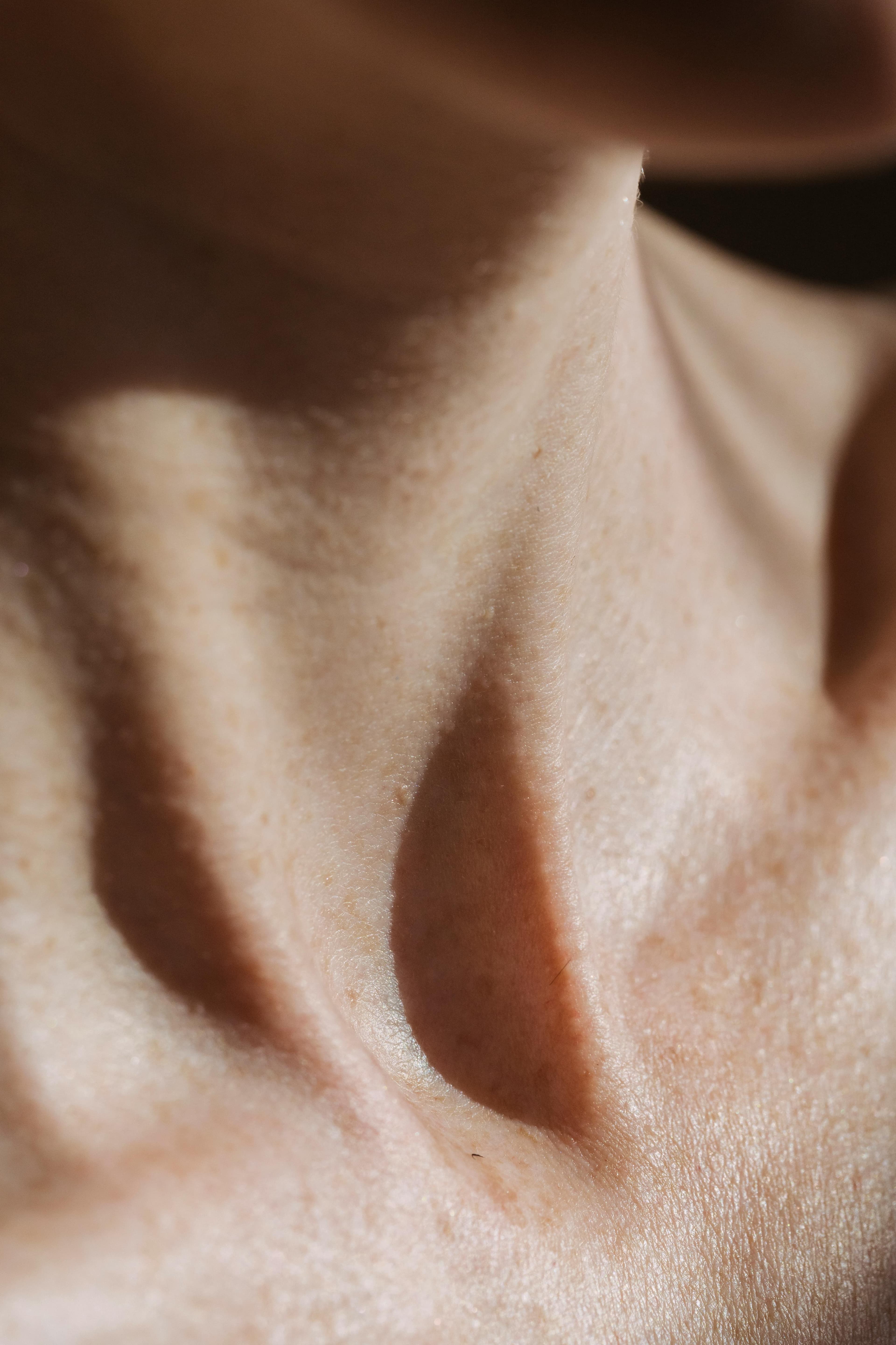 Skin treatment